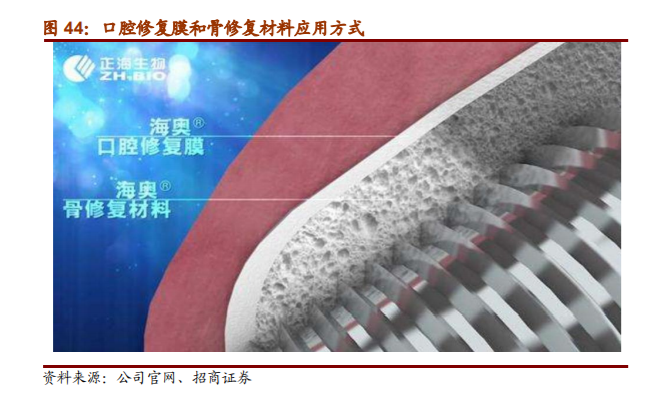 口腔種植牙行業深度報告——招商證券